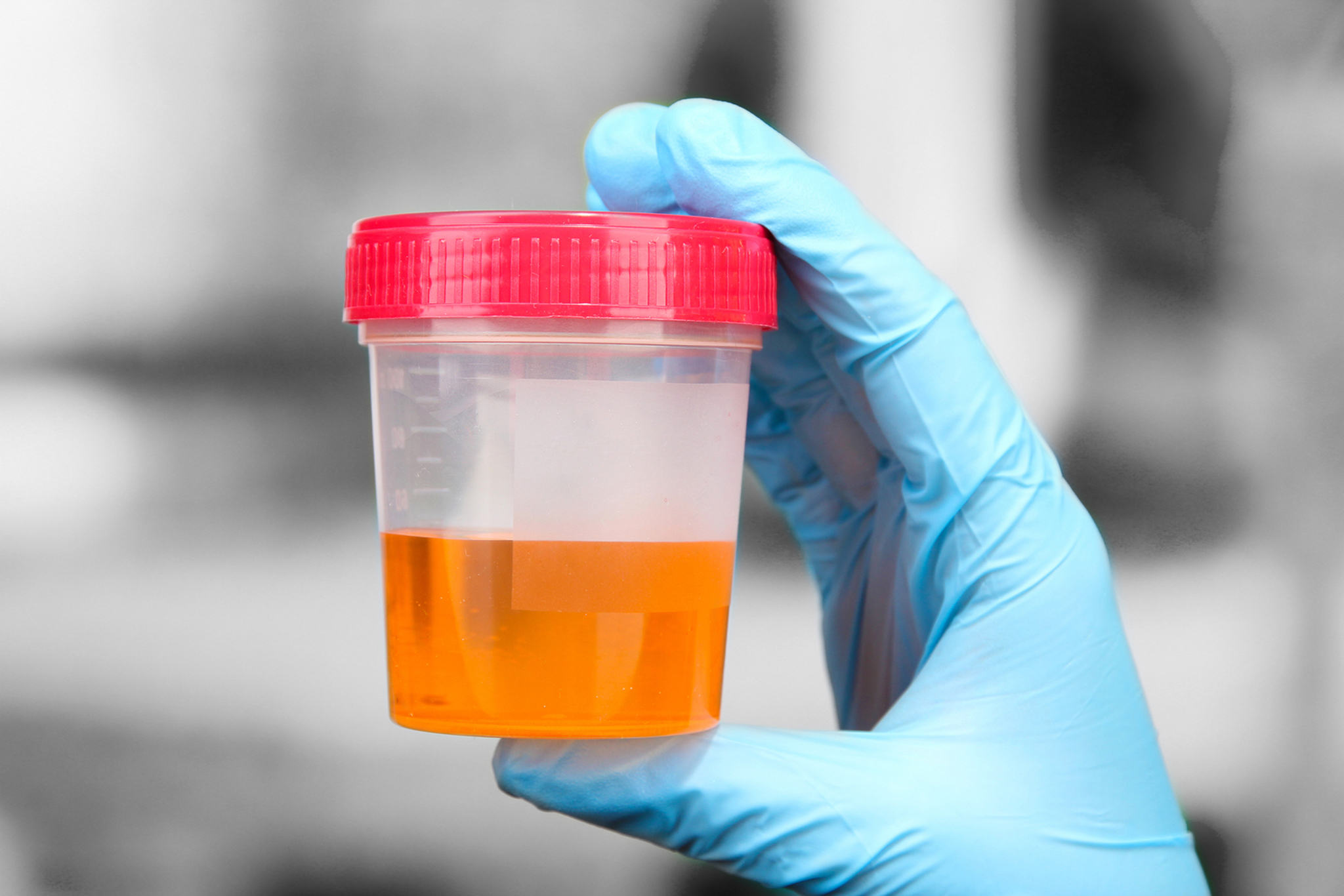 Lei da droga | Testes à urina podem constituir um “abuso”