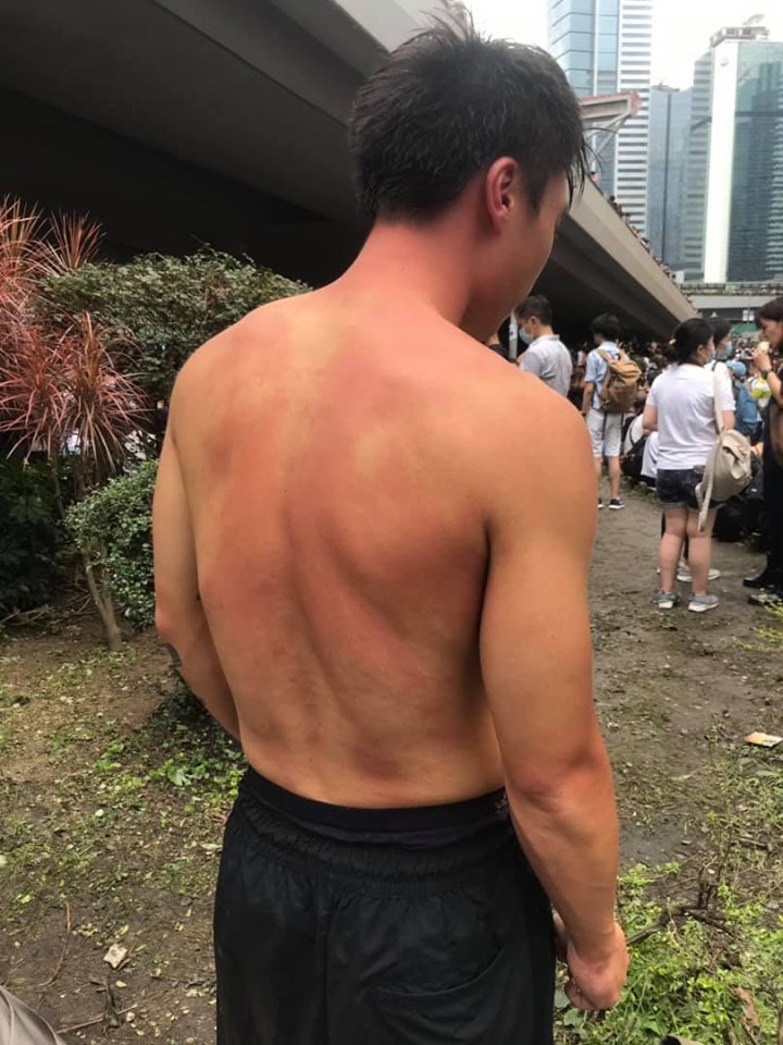 Protestos em Hong Kong | Jornalista de Macau atacado com gás pimenta