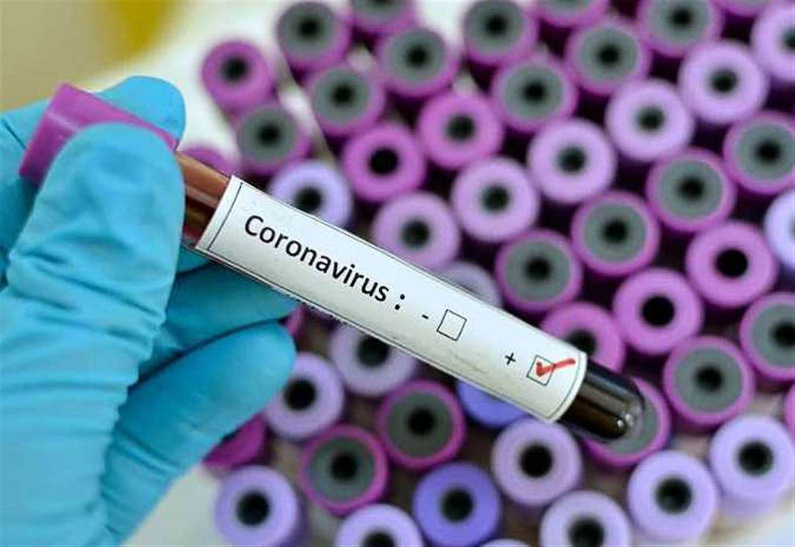 Covid-19 | 12.º caso importado de coronavírus  confirmado em Macau