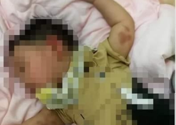 Criança vítima de maus tratos em creche