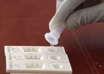 Covid-19 | População tem de realizar testes rápidos amanhã e quinta-feira